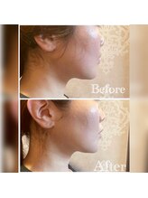 カンコルギセラピー 西新宿店 フレッシュタイム(KAN)/リフトアップ！