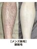 【メンズ脱毛】脚脱毛初回体験¥4,000