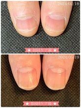 ネイルサロン ベルエトワール(belle etoile)/美爪育成ネイルケア3ヶ月コース