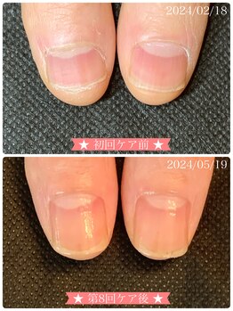 ネイルサロン ベルエトワール(belle etoile)/美爪育成ネイルケア3ヶ月コース