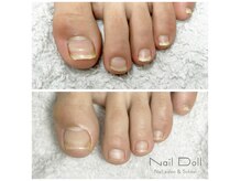 ネイルドール(Nail Doll)の雰囲気（ジェルで巻き爪ケア）