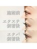 初回限定★《エクパ》史上最高のパッチリ目元【ＬＥＤエクステ】×【マツパ】