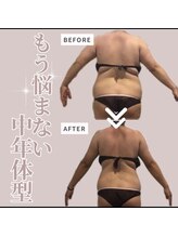 ソワン(Soin)/50代　上半身