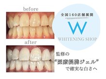エヌエーホワイトニング たまプラーザ店(NA whitening)の雰囲気（160店舗展開のホワイトニングショップ監修高品質なジェルを使用）