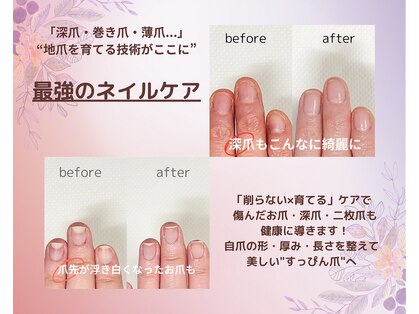 ナユネイル(na_yu.nail)の写真