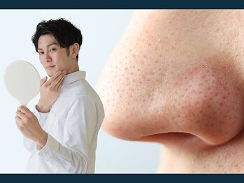 ハリランス(HARILANCE)の写真/【男の肌を磨く！毛穴洗浄×モテ肌美容鍼】皮脂が多い男性は毛穴ケア必須☆肌荒れしにくいお肌作りを！