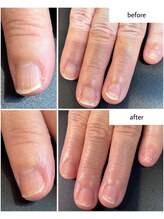 ケアプラス(care plus)/ハンドネイルケア