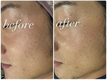 クラスペディア 嘉島店/男性にも大人気！ララピール