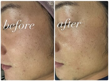 クラスペディア 嘉島店/男性にも大人気!ララピール