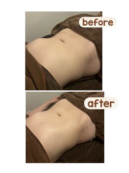 アネクル(ANECUL)/