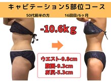 ビーバランス 本町店(美-Balance)/50代前半　月5部位コース