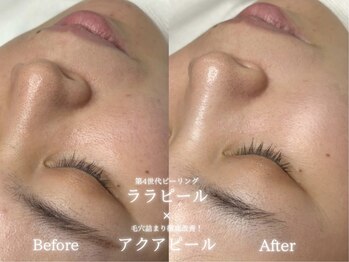 リル 和歌山市店(lilou)/ララ+アクアピールBefore after