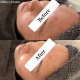 エムビューティーサロン(M Beauty Salon)