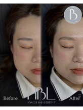 エンテラス 徳島(ENTERAS)/before/after