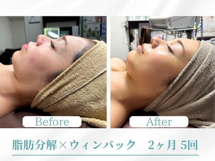 ボディコンディションの写真