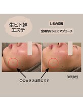 モーイエンチャーム(mooi en charme)/フェイシャル×生ヒト幹50％導入