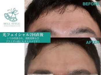 ベルスタイル(Bell style)/当店のお客様症例