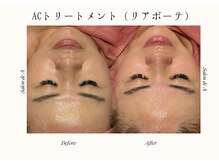 サロンドエー 帝塚山(Salon de A)/艶肌＋小顔の夢叶うメニュー！