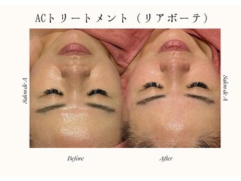 サロンドエー 帝塚山(Salon de A)/艶肌+小顔の夢叶うメニュー!