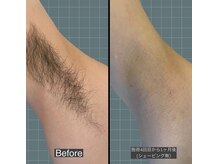 アレッド 大阪店(ared.)/夏に向けて！