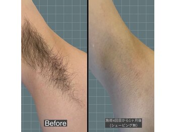 アレッド 大阪店(ared.)/夏に向けて！