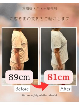 東船橋スタンス整体院の写真/【魅せるウエストにシフト！】国家資格者の熟練技で叶える最大-9cmの魔法のくびれメイク整体☆