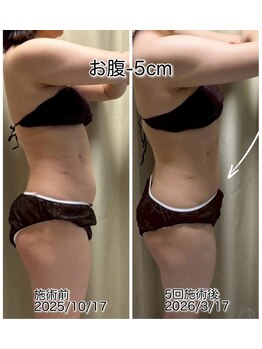 クールスパ(COOL SPA)/【100カップ途中経過】