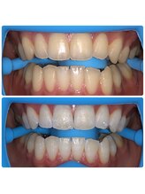 コナホワイトニング 神保町/セルフホワイトニング神保町