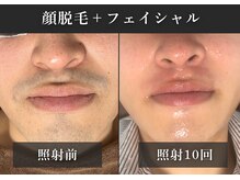 エルモリア(ELMOREA)の雰囲気（【メンズ特化型脱毛】最新機種導入で効果抜群脱毛が可能♪）