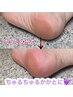 カチカチかかとに!ちゅるちゅるかかとケア
