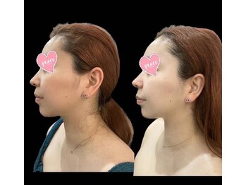 モッド(MOD)/ヴァルモン