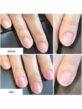 ケアプラス(care plus)/ハンドネイルケア