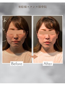 東船橋スタンス整体院の写真/【お顔に触れない小顔矯正整体】メイクしたまま、大切なイベント当日にも◎記念写真の写りを史上最高に♪