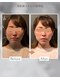東船橋スタンス整体院の写真/【お顔に触れない小顔矯正整体】メイクしたまま、大切なイベント当日にも◎記念写真の写りを史上最高に♪