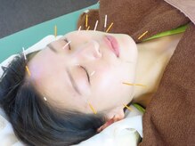 鴨居よつば整骨院/美容鍼