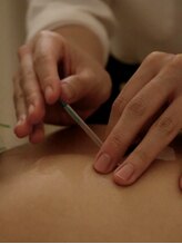 モーンガータ 姫路(Mangata)/やさしく丁寧な鍼