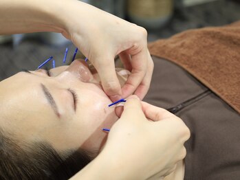 リベルタ鍼灸整骨院 新宿院(Liberta鍼灸整骨院)/美容メニューもございます！！