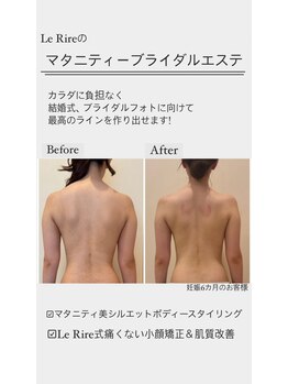ルリール(Le Rire)/マタニティーブライダルエステ