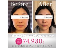 小顔屋ゆらやぎ