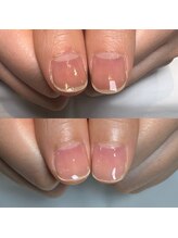 キュア(Cure.)/ジェルを使わない地爪育成ケア