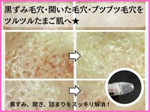 サロン ド ボーテ プルーラ(Salon de beaute PLURA)