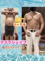 フォト トリートメント シエル(ciel) パーソナル K