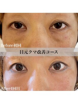 アール アンド ビューティーサロン(Ｒ＆ BeautySalon)/目元クマ・眼精疲労