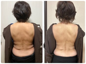 高槻 インサイド(Inside)/ビフォー・アフター