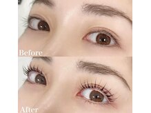 レピア 高槻店/韓国式LEPIA Before&After