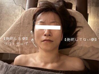 首の休日/【施術事例】