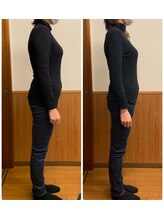 リンドール(RinDoll)/40代女性ダイエット/耳ツボ/痩身