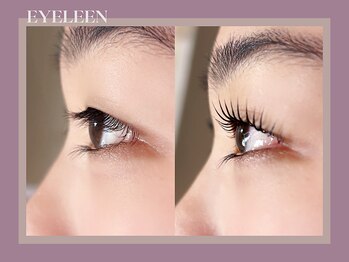 アイリーン(Eyeleen)/Before After