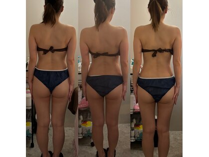 ポノピピ(ponopipi)の写真