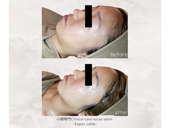 エスポワールカルド(Espoir caldo)/